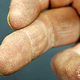 Illustration for article titled Regrowing Fingers Using Pig Bladders